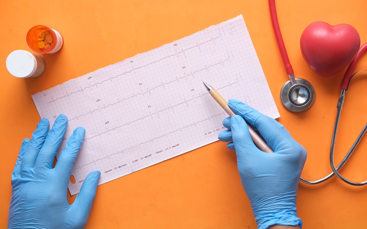 Clinician reviewing an ECG printout beside a heart model